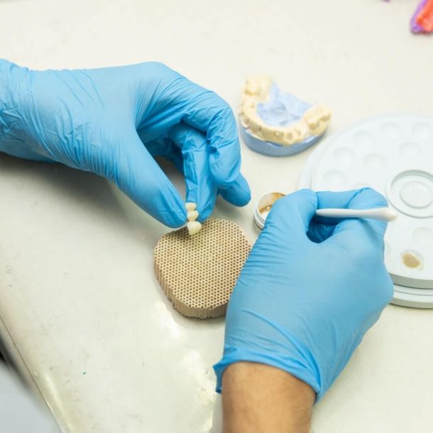 Metody uzupełniania uzębienia